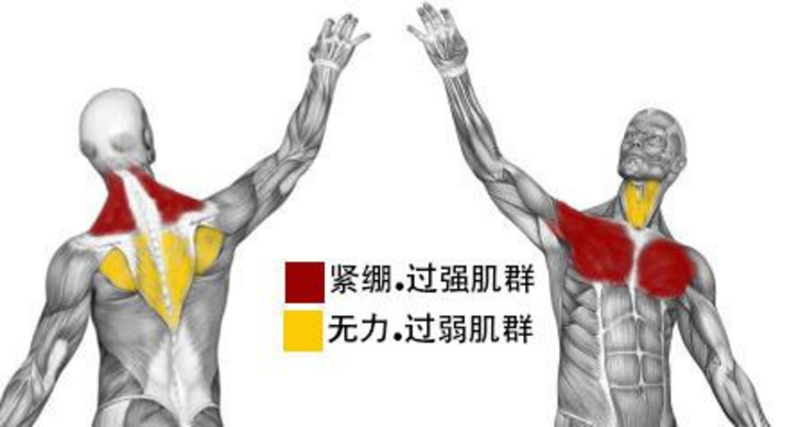 你知道女生圆背 乌龟脖儿多难看 分享些我在这方面的努力与心得 很赞 你知道女生圆背 乌龟脖儿多难看 分享些我在这方面的努力与心得 很赞