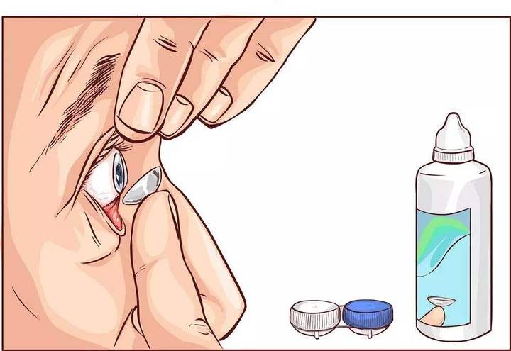 软性隐形眼镜怎么选 9个安全舒适的隐形眼镜品牌推荐 很赞